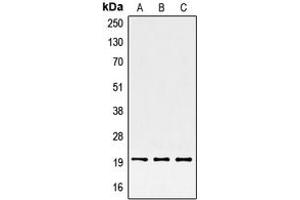 Western blot analysis of SRSF3 expression in HepG2 (A), HeLa (B), BJAB (C) whole cell lysates. (SRSF3 Antikörper  (C-Term))