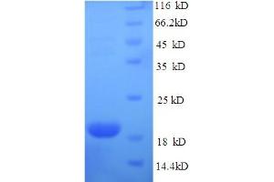SDS-PAGE (SDS) image for Interferon epsilon (IFNE) (AA 22-192) protein (His-SUMO Tag) (ABIN5711491)