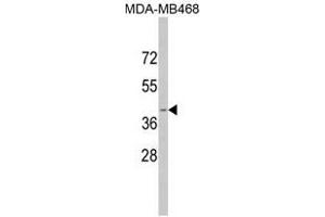 Image no. 1 for anti-Apolipoprotein L, 1 (APOL1) (BH3 Domain) antibody (ABIN452749)