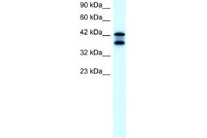 WB Suggested Anti-ACAT2 Antibody Titration:  2. (ACAT2 Antikörper  (Middle Region))