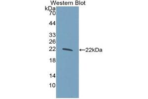Western blot analysis of the recombinant protein. (GCKR Antikörper  (AA 320-499))