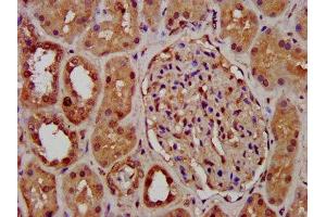 IHC image of ABIN7163794 diluted at 1:400 and staining in paraffin-embedded human kidney tissue performed on a Leica BondTM system. (PCGF1 Antikörper  (AA 113-187))