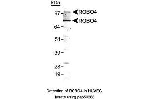Image no. 1 for anti-Roundabout, Axon Guidance Receptor, Homolog 4 (ROBO4) (AA 200-300), (Internal Region) antibody (ABIN363597) (ROBO4 Antikörper  (Internal Region))
