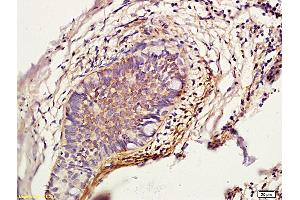 Cathepsin L Antikörper  (AA 71-170)