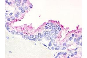 Anti-GPR21 antibody IHC of human prostate. (GPR21 Antikörper  (Cytoplasmic Domain))