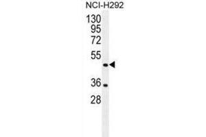 Western Blotting (WB) image for anti-Tripartite Motif Containing 72 (TRIM72) antibody (ABIN2996476) (TRIM72 Antikörper)