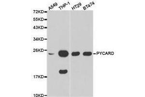 Western Blotting (WB) image for anti-Steroid Sulfatase (STS) antibody (ABIN1874484) (STS Antikörper)