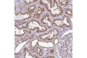 Immunohistochemical staining of human kidney with CLTA polyclonal antibody  shows strong membranous positivity in cells in tubules at 1:2500-1:5000 dilution. (CLTA Antikörper)