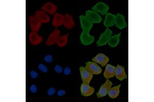 ABIN6262581 and ABIN6276765 staining Hela cells(30 min of UV treatment) by IF/ICC. (IDO1 Antikörper  (Internal Region))
