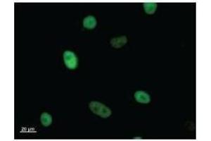 Immunostaining analysis in HeLa cells. (KIF22 Antikörper)