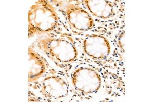 Immunohistochemistry analysis of paraffin-embedded human colon using,SATB2 (ABIN7075514) at dilution of 1: 1500 (SATB2 Antikörper)