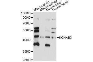 Western Blotting (WB) image for anti-Potassium Voltage-Gated Channel, Shaker-Related Subfamily, beta Member 3 (KCNAB3) antibody (ABIN6292719)