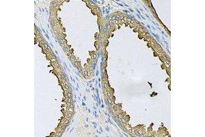 Immunohistochemical analysis of SRP19 staining in human prostate formalin fixed paraffin embedded tissue section. (SRP19 Antikörper)