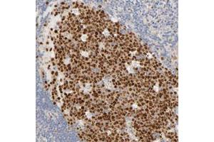 Immunohistochemical staining (Formalin-fixed paraffin-embedded sections) of human lymph node with MEF2B polyclonal antibody  shows strong nuclear expression in germinal center cells.