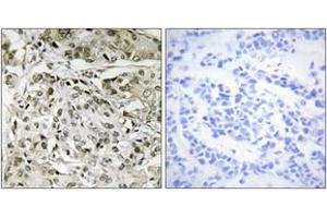 Immunohistochemistry (IHC) image for anti-TAF1 RNA Polymerase II, TATA Box Binding Protein (TBP)-Associated Factor, 250kDa (TAF1) (AA 1131-1180) antibody (ABIN1533657)