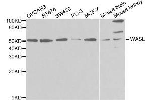 Western blot analysis of extracts of various cell lines, using WASL antibody (ABIN5971401) at 1/1000 dilution. (Neural Wiskott-Aldrich syndrome protein (WASL) Antikörper)