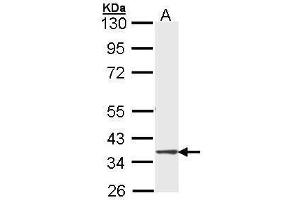 WB Image Sample (30 ug of whole cell lysate) A: Molt-4 , 10% SDS PAGE antibody diluted at 1:1000 (DMC1 Antikörper  (Center))
