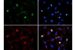 Fluorescence Microscopy (FM) image for anti-Histone 3 (H3) (H3K56me3) antibody (ABIN5706777)