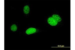 Immunofluorescence of monoclonal antibody to AURKB on HeLa cell. (Aurora Kinase B Antikörper  (AA 1-90))