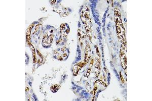 Immunohistochemistry of paraffin-embedded human placenta using APOE Rabbit pAb (ABIN6133561, ABIN6137017, ABIN6137019 and ABIN6213793) at dilution of 1:50 (40x lens). (APOE Antikörper  (AA 200-300))