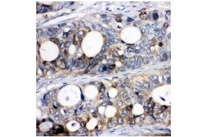IHC analysis of Stathmin 1 using anti-Stathmin 1 antibody (ABIN3043301).