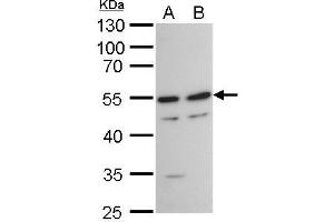 WB Image TAF7 antibody detects TAF7 protein by western blot analysis. (TAF7 Antikörper  (Center))