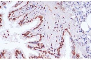 Immunohistochemistry (Paraffin-embedded Sections) (IHC (p)) image for anti-Histone H3 (H3) (acLys14), (acLys18), (acLys23), (acLys27), (acLys9) antibody (ABIN7259751)