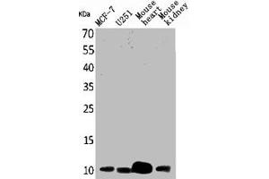 Western Blot analysis of MCF7 U251 mouse liver mouse kidney cells using ACBP Polyclonal Antibody (Diazepam Binding Inhibitor Antikörper  (C-Term))