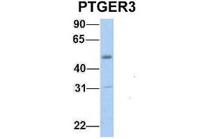 Host:  Rabbit  Target Name:  PTGER3  Sample Type:  Human Fetal Muscle  Antibody Dilution:  1. (PTGER3 Antikörper  (C-Term))