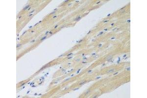 Immunohistochemistry of paraffin-embedded Mouse heart using WDR77 Polyclonal Antibody at dilution of 1:200 (40x lens). (WDR77 Antikörper)