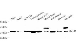 Western blot analysis of tbc1d7 (ABIN7075849) at dilution of 1: 500 (TBC1D7 Antikörper)