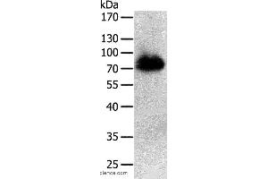 Western blot analysis of Human liver cancer tissue, using PRMT7 Polyclonal Antibody at dilution of 1:500 (PRMT7 Antikörper)