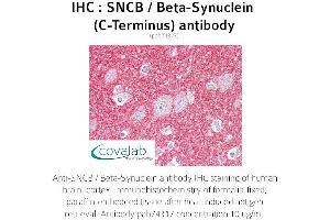 Image no. 1 for anti-Synuclein, beta (SNCB) antibody (ABIN1739479) (beta Synuclein Antikörper)