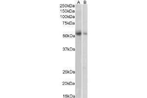 ABIN5855385 (1 µg/ml) staining of Human Placenta (A) and Human Adrenal Gland (B) lysate (35 µg protein in RIPA buffer). (SLC18A2 Antikörper)