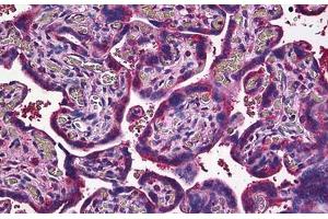 Human Placenta: Formalin-Fixed, Paraffin-Embedded (FFPE) (JAM2 Antikörper  (AA 29-299))