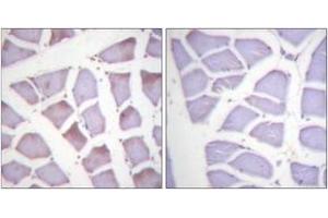 Immunohistochemistry analysis of paraffin-embedded human skeletal muscle, using XIAP (Phospho-Ser87) Antibody. (Intestinal Alkaline Phosphatase Antikörper  (pSer87))