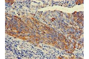 Immunohistochemistry (IHC) image for anti-Keratin 7 (KRT7) (AA 2-469) antibody (ABIN7157444)