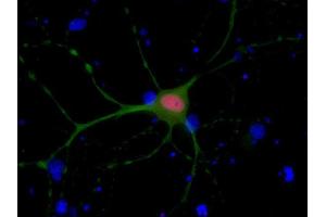 Indirect immunostaining of PFA fixed rat hippocampus neurons with anti-Ctip 2 (dilution 1 : 500; red) and mouse anti-MAP 2 (, dilution 1 : 500; green). (BCL11B Antikörper  (AA 541-812))