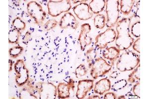 Paraformaldehyde-fixed, paraffin embedded human kidney tissue, Antigen retrieval by boiling in sodium citrate buffer(pH6) for 15min, Block endogenous peroxidase by 3% hydrogen peroxide for 30 minutes, Blocking buffer (normal goat serum) at 37°C for 20min, Antibody incubation with Rabbit Anti-EphB2 R Polyclonal Antibody, Unconjugated  at 1:200 overnight at 4°C, followed by a conjugated secondary and DAB staining (EphB2 R (AA 101-200) Antikörper)