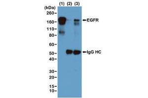 IP of EGF-treated human A431 cells by the recombinant Phosphotyrosine antibody at 1:1000 and blotted with an anti-EGFR mAb.
