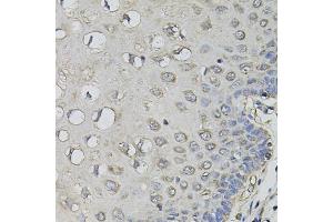 Immunohistochemistry of paraffin-embedded human esophagus using AMPD1 antibody (ABIN5995393) (40x lens). (AMPD1 Antikörper)