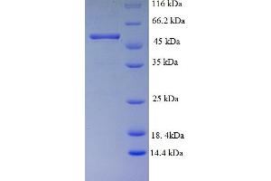 SDS-PAGE (SDS) image for Receptor tyrosine-protein kinase erbB-2 (ErbB2/Her2) (AA 153-598) protein (His tag) (ABIN5712706)