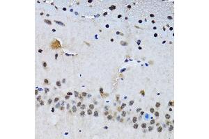 Immunohistochemistry of paraffin-embedded mouse brain using BIRC7 antibody. (BIRC7 Antikörper)