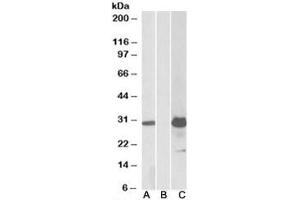 Western blot testing of HEK293 lysate overexpressing human KCTD11-FLAG with KCTD11 antibody (1ug/ml) in lane A and anti-FLAG (1/5000) in lane C. (KCTD11 Antikörper)