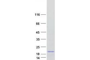 Validation with Western Blot (ATP6V1G3i Protein (Transcript Variant 1) (Myc-DYKDDDDK Tag))