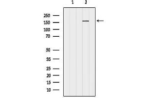 anti-RPGRIP1-Like (RPGRIP1L) (N-Term) antibody