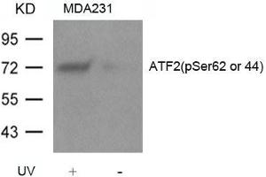 Western blot analysis of extracts from MDA231 cells untreated or treated with UV using ATF2(Phospho-Ser62 or 44) Antibody. (ATF2 Antikörper  (pSer62))
