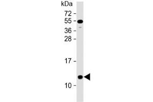 Western blot testing of human heart lysate with NDUFA2 antibody at 1:2000. (NDUFA2 Antikörper  (AA 62-96))