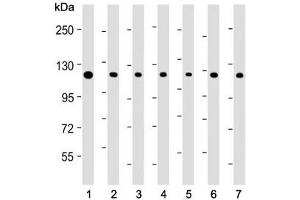 Western Blotting (WB) image for anti-Telomerase Reverse Transcriptase (TERT) (AA 627-656) antibody (ABIN3029108)
