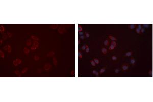 Immunofluorescence (fixed cells) (IF/ICC) image for anti-Endothelin Receptor Type B (EDNRB) (C-Term) antibody (ABIN6266206)